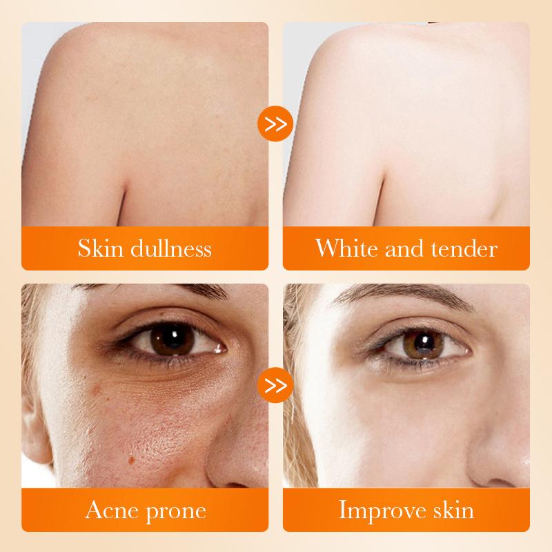 1Pz SADOER Sapone Viso all'Aci - Kojic Acid Soap recensione e prezzo