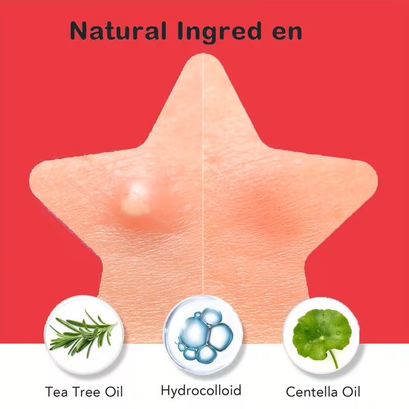 200/400 Pezzi Cerotti per Acne - Skincare Oil Control recensione e prezzo